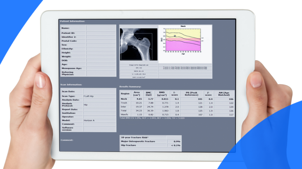 A person looking at a dexa scan report on a tablet