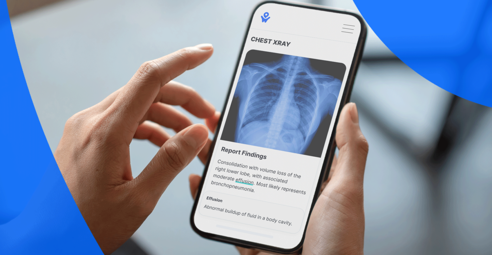 Patient viewing X-ray on PocketHealth