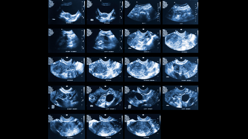 Various pelvic ultrasounds