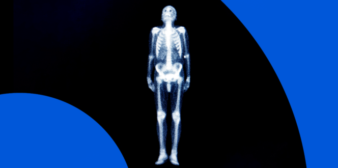 Full body bone scan