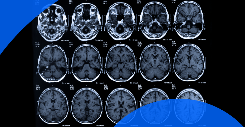 Brain scan