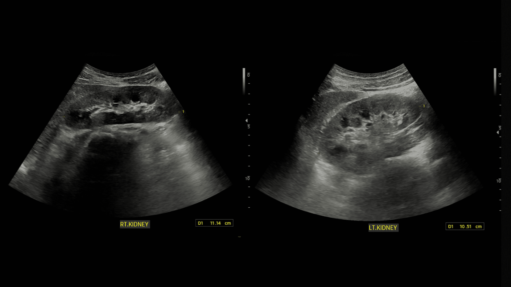 Ultrasounds of the kidneys