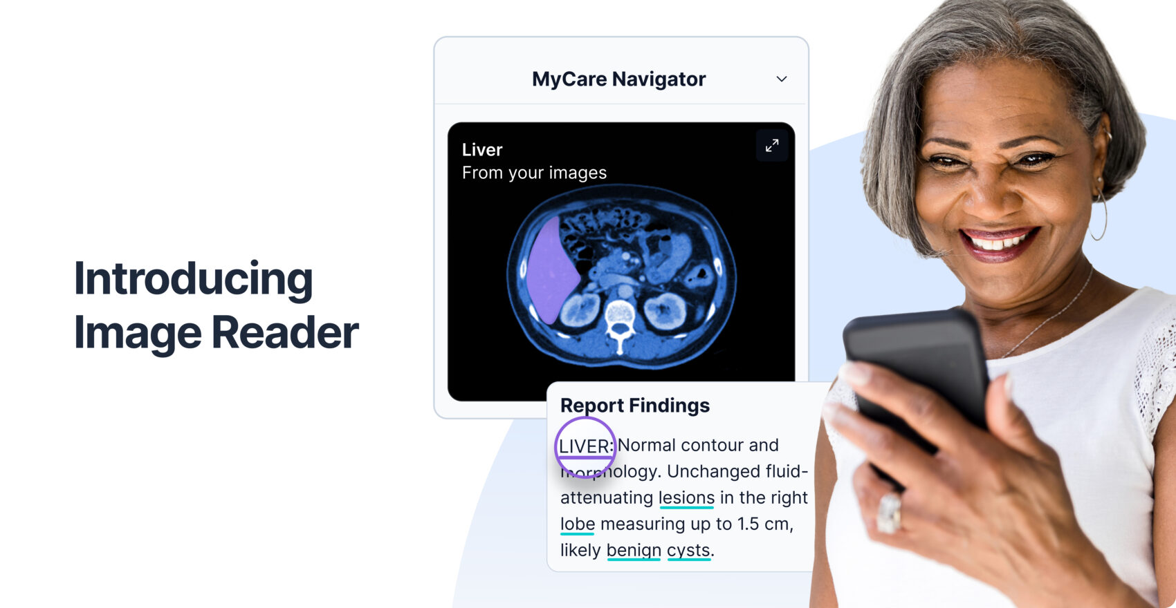 PocketHealth launches Image Reader, the first AI-powered tool that adds anatomical visualization directly to patient imaging records.