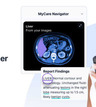 PocketHealth launches Image Reader, the first AI-powered tool that adds anatomical visualization directly to patient imaging records.