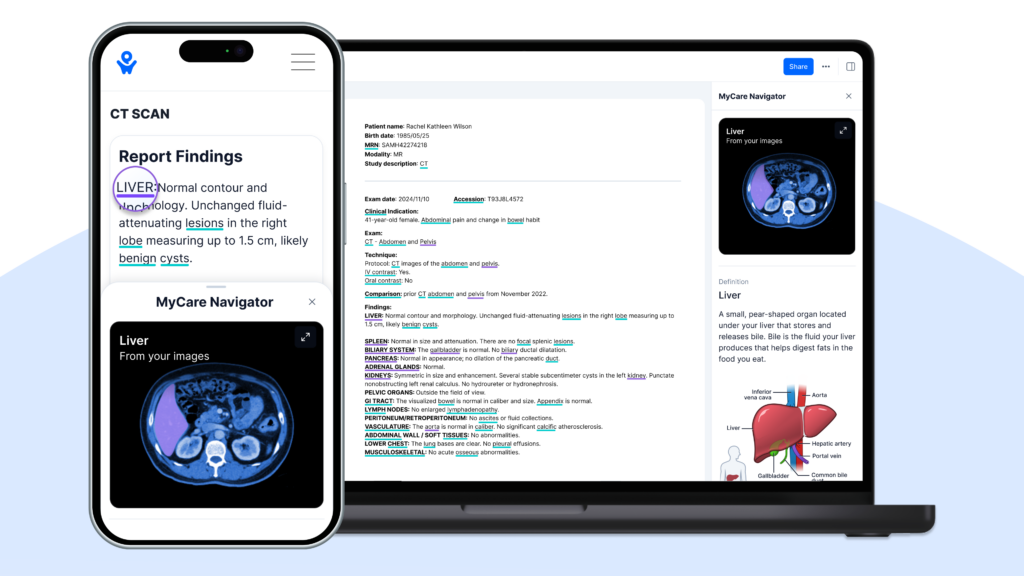 PocketHealth Unveils Image Reader to Eliminate Guesswork for Patients ...