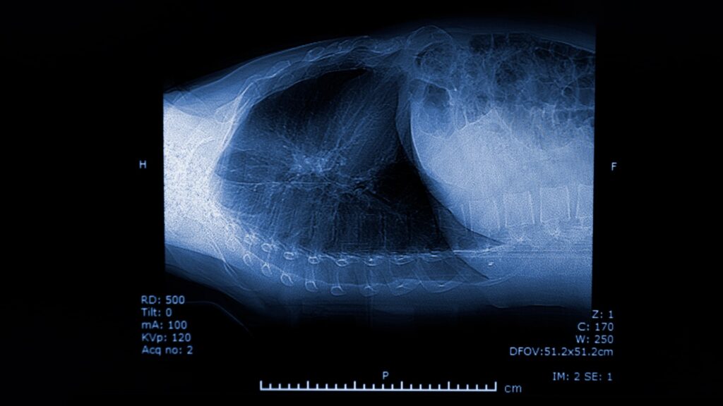 CT scan of the chest organs