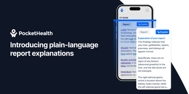 Plain-language report explanations with AI